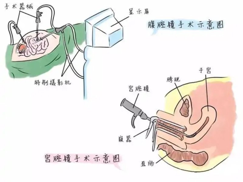 赤峰妇科医院:守护女性健康的小卫士